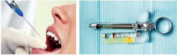 胰島素，牙科麻醉6.png